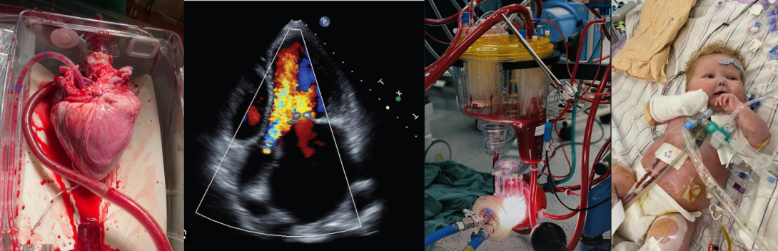 Tecniche di Fisiopatologia Cardiocircolatoria e Perfusione Cardiovascolare 